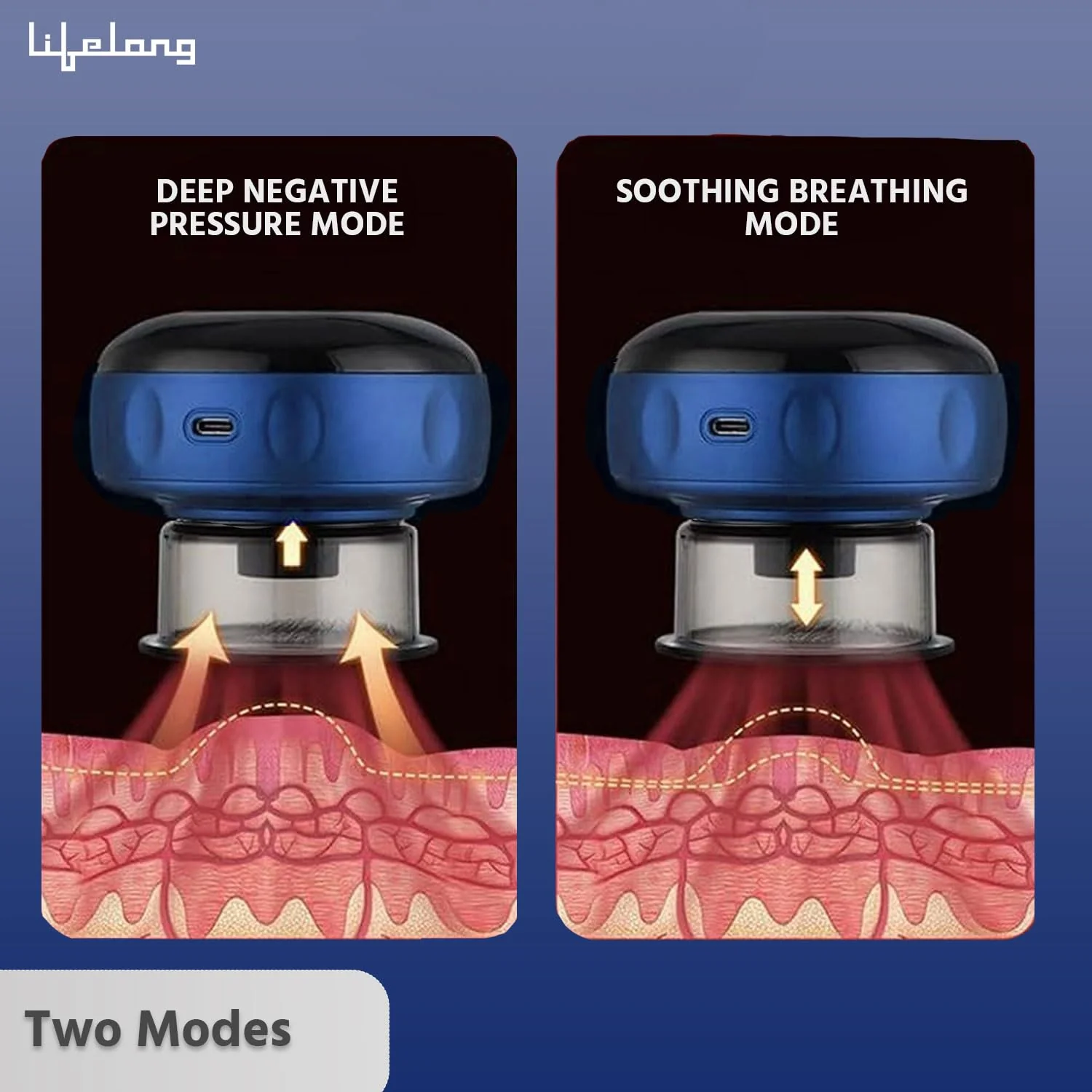 Smart cupping set - Image 4